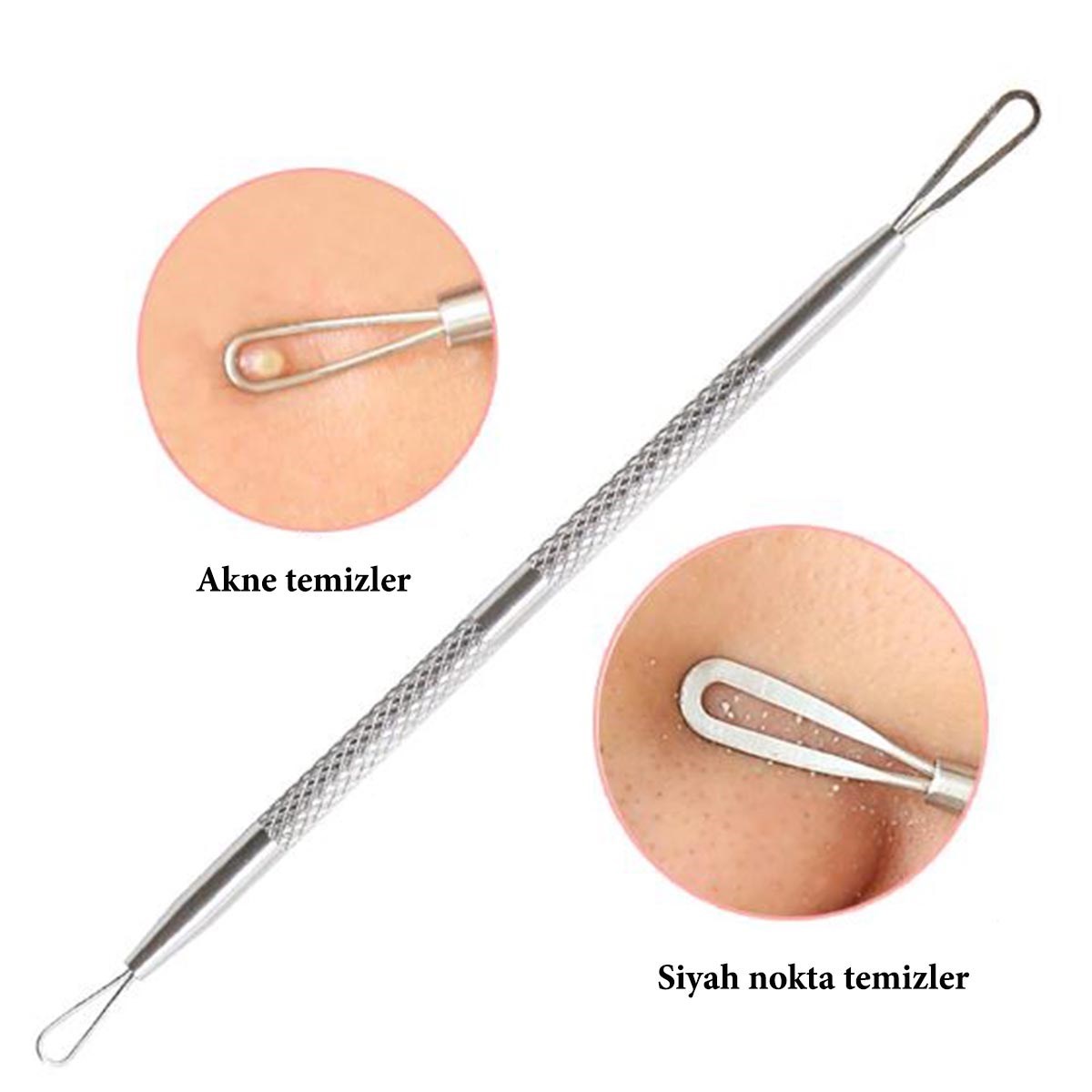 Paslanmaz Çelik Siyah Nokta Sivilce ve Akne Temizleyici Set 3&apos;lü Kit